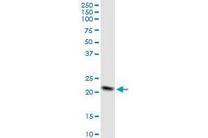 NDUFB10 MaxPab polyclonal antibody.