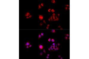 Immunofluorescence analysis of HeLa cells using GLUD2 antibody (ABIN5973969) at dilution of 1/100 (40x lens). (GLUD2 anticorps)