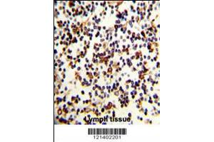 Formalin-fixed and paraffin-embedded human Lymph reacted with CR2 Antibody , which was peroxidase-conjugated to the secondary antibody, followed by DAB staining.