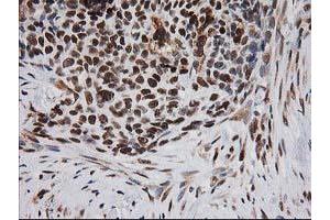 Immunohistochemistry (IHC) image for anti-Excision Repair Cross-Complementing Rodent Repair Deficiency, Complementation Group 4 (ERCC4) antibody (ABIN1498070)