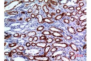 Immunohistochemistry (IHC) analysis of paraffin-embedded Human Kidney, antibody was diluted at 1:100. (XRCC6 anticorps  (Ser408))