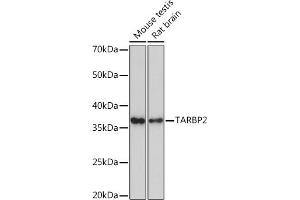 Western blot analysis of extracts of various cell lines, using T Rabbit mAb (ABIN7270729) at 1:1000 dilution. (TARBP2 anticorps)