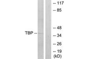 Western blot analysis of extracts from 293 cells, using TBP Antibody. (TBP anticorps  (AA 151-200))