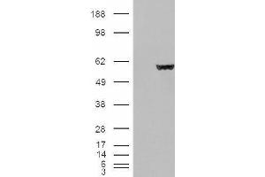 HEK293 overexpressing Fumarase (ABIN5498812) and probed with ABIN190758 (mock transfection in first lane). (FH anticorps  (Internal Region))