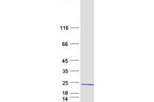 Validation with Western Blot