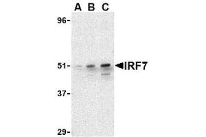 Image no. 1 for anti-Interferon Regulatory Factor 7 (IRF7) (C-Term) antibody (ABIN265129) (IRF7 anticorps  (C-Term))