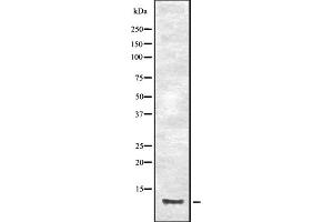 Western blot analysis of CCL23 expression in HEK293 cells ,The lane on the left is treated with the antigen-specific peptide.