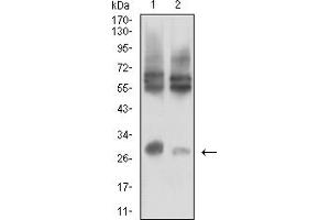Western blot analysis using CD215 mouse mAb against LOVO (1) and HCT116 (2) cell lysate. (IL15RA anticorps  (AA 31-205))