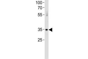 ATF7 antibody western blot analysis in huamn placenta tissue lysate