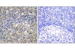 Immunohistochemistry analysis of paraffin-embedded human tonsil tissue, using p47 phox (Ab-370) Antibody.