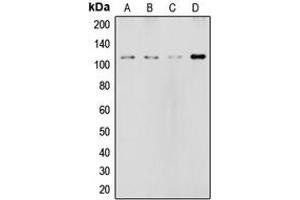 Western blot analysis of NOTCH2 expression in HeLa (A), MCF7 (B), rat liver (C), NIH3T3 (D) whole cell lysates. (NOTCH2 anticorps  (Center))