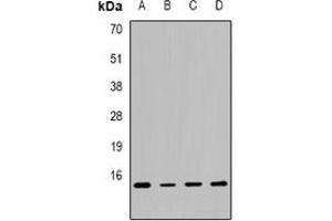 Western blot analysis of Calcitonin expression in MCF7 (A), SW480 (B), mouse lung (C), mouse liver (D) whole cell lysates. (Calcitonin anticorps  (C-Term))