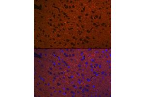 Immunofluorescence analysis of rat brain using STX1A Rabbit mAb (ABIN7270684) at dilution of 1:100 (40x lens).