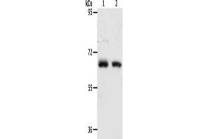 Gel: 8 % SDS-PAGE, Lysate: 40 μg, Lane 1-2: Human fetal kidney tissue, Human fetal lung tissue, Primary antibody: ABIN7128162(ACOT11 Antibody) at dilution 1/450, Secondary antibody: Goat anti rabbit IgG at 1/8000 dilution, Exposure time: 90 seconds (ACOT11 anticorps)