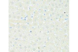 Immunohistochemistry of paraffin-embedded Rat liver using TRIM15 Polyclonal Antibody at dilution of 1:100 (40x lens). (TRIM15 anticorps)
