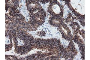 Image no. 4 for anti-Signal Recognition Particle Receptor, B Subunit (SRPRB) antibody (ABIN1501126)