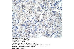 Rabbit Anti-SF3B1 Antibody  Paraffin Embedded Tissue: Human Liver Cellular Data: Hepatocytes Antibody Concentration: 4. (SF3B1 anticorps  (Middle Region))