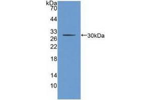 Detection of Recombinant CHRNb2, Human using Polyclonal Antibody to Cholinergic Receptor, Nicotinic, Beta 2 (CHRNb2)