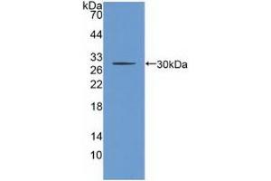 Detection of Recombinant CHRNb2, Human using Polyclonal Antibody to Cholinergic Receptor, Nicotinic, Beta 2 (CHRNb2) (CHRNB2 anticorps  (AA 86-244))