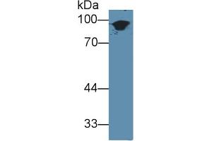 Detection of CK1 in Mouse Skin lysate using Polyclonal Antibody to Cytokeratin 1 (CK1) (Cytokeratin 1 anticorps  (AA 189-497))