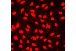 IF analysis of NHEJ1 using anti-NHEJ1 antibody (ABIN7599198). (NHEJ1 anticorps  (AA 1-273))