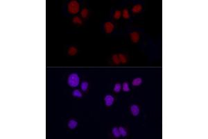 Immunofluorescence analysis of NCI-H460 using Brachyury Rabbit mAb (ABIN1682626, ABIN3019362, ABIN3019363 and ABIN7101757) at dilution of 1:100 (40x lens). (Scinderin anticorps)