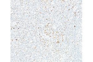Immunohistochemistry (IHC) image for anti-Runt-Related Transcription Factor 2 (RUNX2) (AA 300-350) antibody (ABIN7795798) (Recombinant RUNX2 anticorps  (AA 300-350))