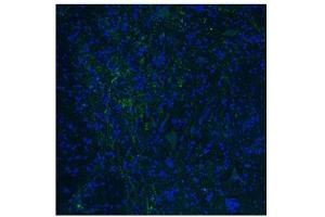 Immunofluorescence -- Dilution: 1.