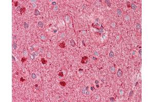 Anti-DCX / Doublecortin antibody IHC staining of human brain, cortex. (Doublecortin anticorps)