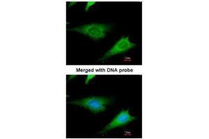 ICC/IF Image Immunofluorescence analysis of paraformaldehyde-fixed HeLa, using ribosomal protein S3a, antibody at 1:200 dilution. (RPS3A anticorps)