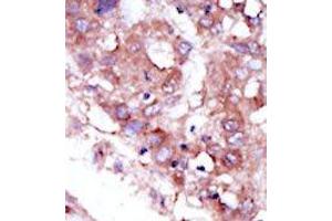 Image no. 1 for anti-serine/threonine Kinase 33 (STK33) (C-Term) antibody (ABIN359942) (STK33 anticorps  (C-Term))