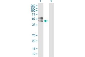 Western Blot analysis of RTN4R expression in transfected 293T cell line by RTN4R MaxPab polyclonal antibody. (RTN4R anticorps  (AA 1-473))