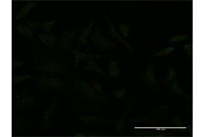 Immunofluorescence of monoclonal antibody to USP9X on HeLa cell. (USP9X anticorps  (AA 1-90))