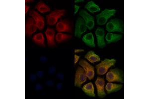 ABIN7093796 and ABIN7097839 staining Hela cells by IF/ICC. (TREM2 anticorps  (C-Term))