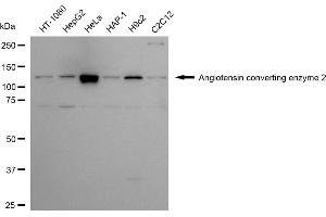 Western blotting analysis using angiotensin converting enzyme 2 antibody (ABIN7797606).