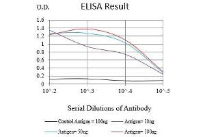 Black line: Control Antigen (100 ng),Purple line: Antigen (10 ng), Blue line: Antigen (50 ng), Red line:Antigen (100 ng) (Bcl-2 anticorps  (AA 1-239))