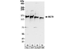 Western Blotting (WB) image for anti-Solute Carrier Family 16 Member 2 (SLC16A2) (AA 250-300) antibody (ABIN7450439)