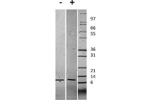 SDS-PAGE of Human Gro Alpha (CXCL1) Recombinant Protein SDS-PAGE of Human Gro Alpha (CXCL1) Recombinant Protein. (CXCL1 Protéine)