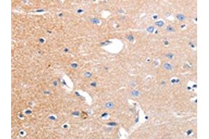 The image on the left is immunohistochemistry of paraffin-embedded Human brain tissue using ABIN7191180(KCNH3 Antibody) at dilution 1/12, on the right is treated with synthetic peptide.