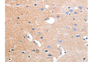 The image on the left is immunohistochemistry of paraffin-embedded Human brain tissue using ABIN7191180(KCNH3 Antibody) at dilution 1/12, on the right is treated with synthetic peptide. (KCNH3 anticorps)