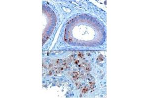 Image no. 1 for anti-Vacuolar Protein Sorting 35 (VPS35) (C-Term) antibody (ABIN374403) (VPS35 anticorps  (C-Term))