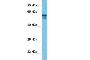 Host:  Rabbit  Target Name:  CSF1  Sample Tissue:  Human Liver Tumor  Antibody Dilution:  1ug/ml