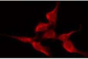 ABIN6275679 staining A549 by IF/ICC. (CACNA1H anticorps  (Internal Region))