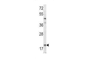 Western blot analysis of Bad BH3 Domain antibody (ABIN388118 and ABIN2846287) in mouse bladder tissue lysates (35 μg/lane). (BAD anticorps  (AA 92-127))