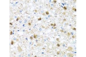 Immunohistochemistry of paraffin-embedded Rat brain using ZBTB17 Polyclonal Antibody at dilution of 1:100 (40x lens). (ZBTB17 anticorps)