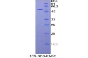 SDS-PAGE (SDS) image for Peroxiredoxin 6 (PRDX6) (AA 1-224) protein (His tag,GST tag) (ABIN2123464)