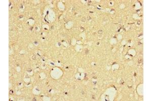 Immunohistochemistry of paraffin-embedded human brain tissue using ABIN7152265 at dilution of 1:100 (Exonuclease 1 anticorps  (AA 301-600))