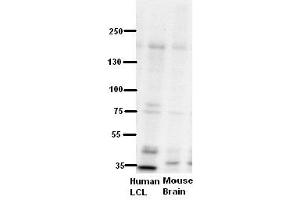 WB Suggested Anti-ZNF294 Antibody Titration:  5% Milk  ELISA Titer:  dilution: 1:500  Positive Control:  human LCL and mouse brains (RNF160 anticorps  (N-Term))