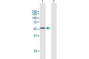 Western Blot analysis of SPOCK2 expression in transfected 293T cell line by SPOCK2 MaxPab polyclonal antibody. (SPOCK2/Testican 2 anticorps  (AA 1-424))