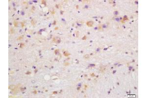 Formalin-fixed and paraffin embedded mouse brain labeled with Rabbit Anti-CYP24A1 Polyclonal Antibody, Unconjugated  at 1:200 followed by conjugation to the secondary antibody and DAB staining